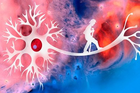 Enfermedad de Alzheimer