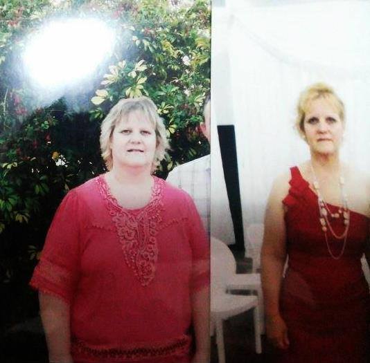 Claudia Berg dramatica perdida de peso medicina integral natural facundo bitsch
